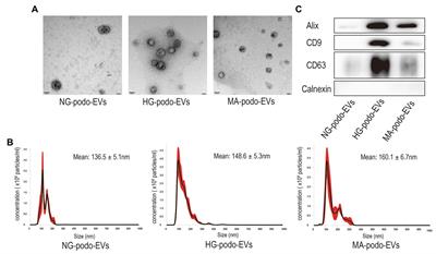 Extracellular Vesicles From High Glucose-Treated Podocytes Induce Apoptosis of Proximal Tubular Epithelial Cells